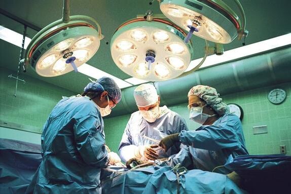 An increase in surgery on experts