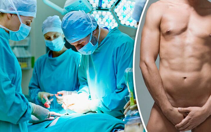 An increase in penis surgery